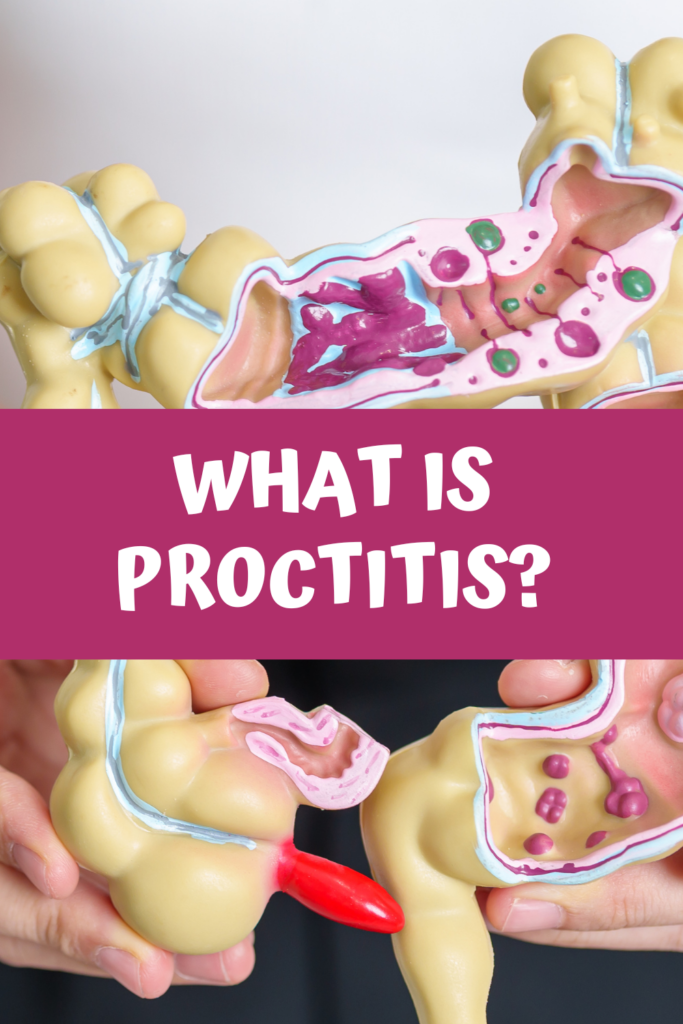 What is Proctitis with A Gutsy Girl agutsygirl.com