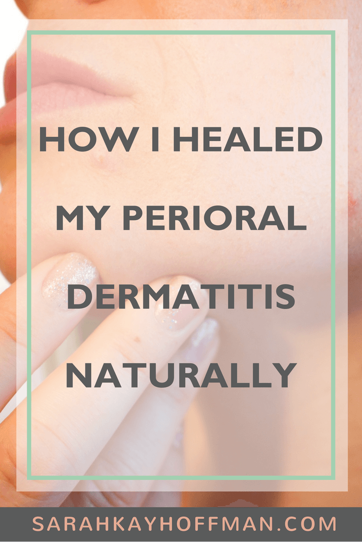 To treat dermatitis how naturally perioral 6 Natural