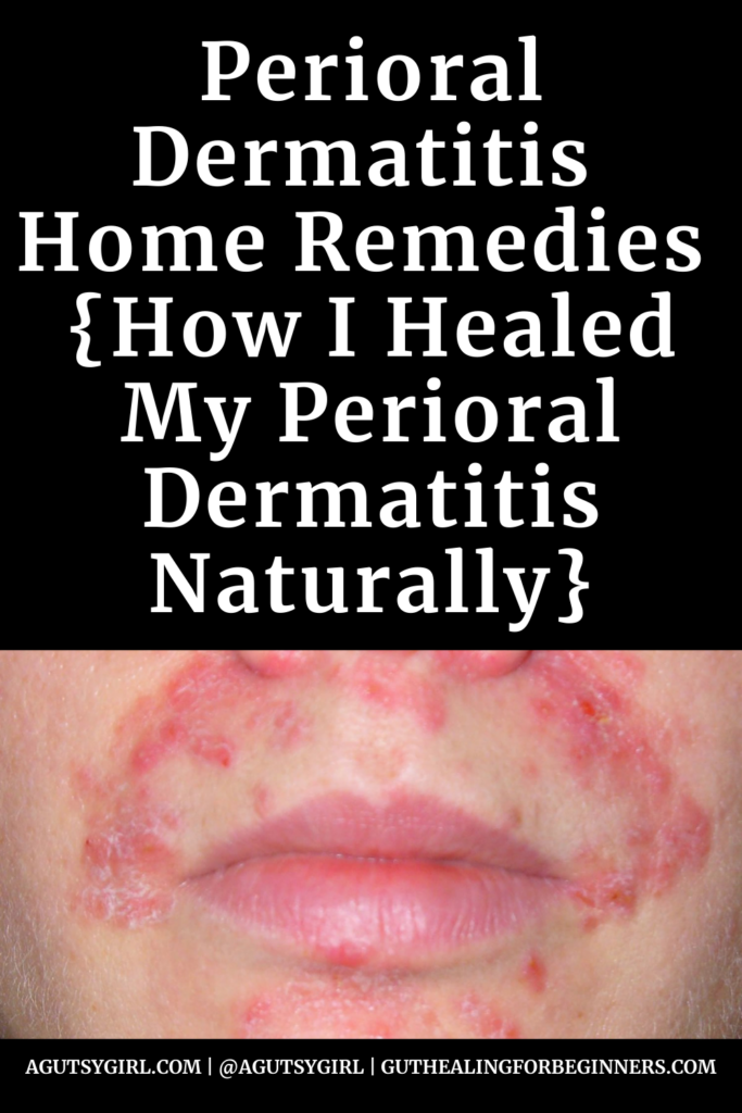 Perioral Dermatitis Home Remedies {How I Healed My Perioral Dermatitis Naturally} agutsygirl.com #perioraldermatitis