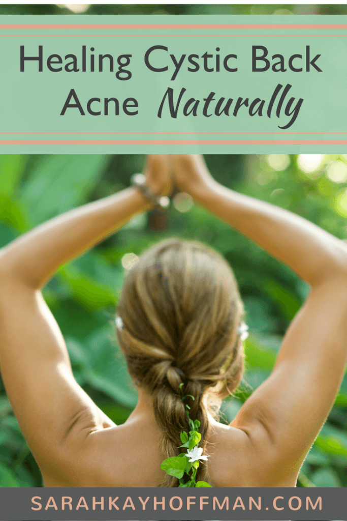 Healing Cystic Back Acne Naturally sarahkayhoffman.com