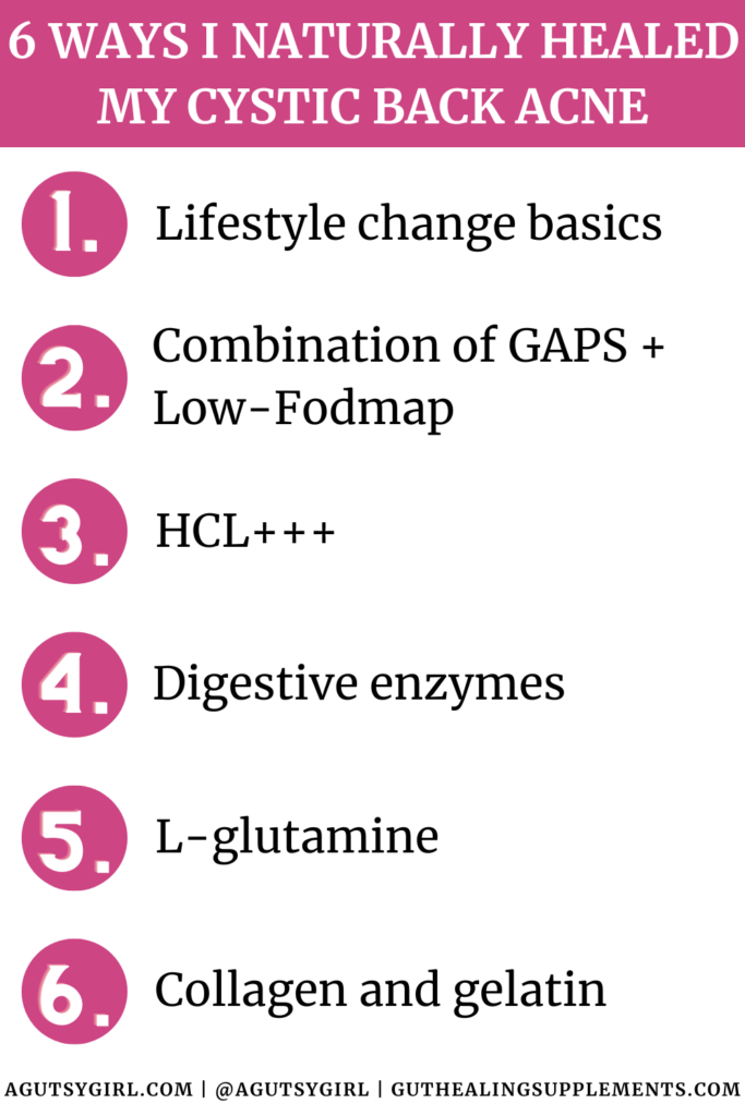 How to Get Rid of Acne Caused by Digestive Problems (Gut-Acne Connection) 6 Ways I naturally healed my cystic back acne agutsygirl.com #acne #gutacne