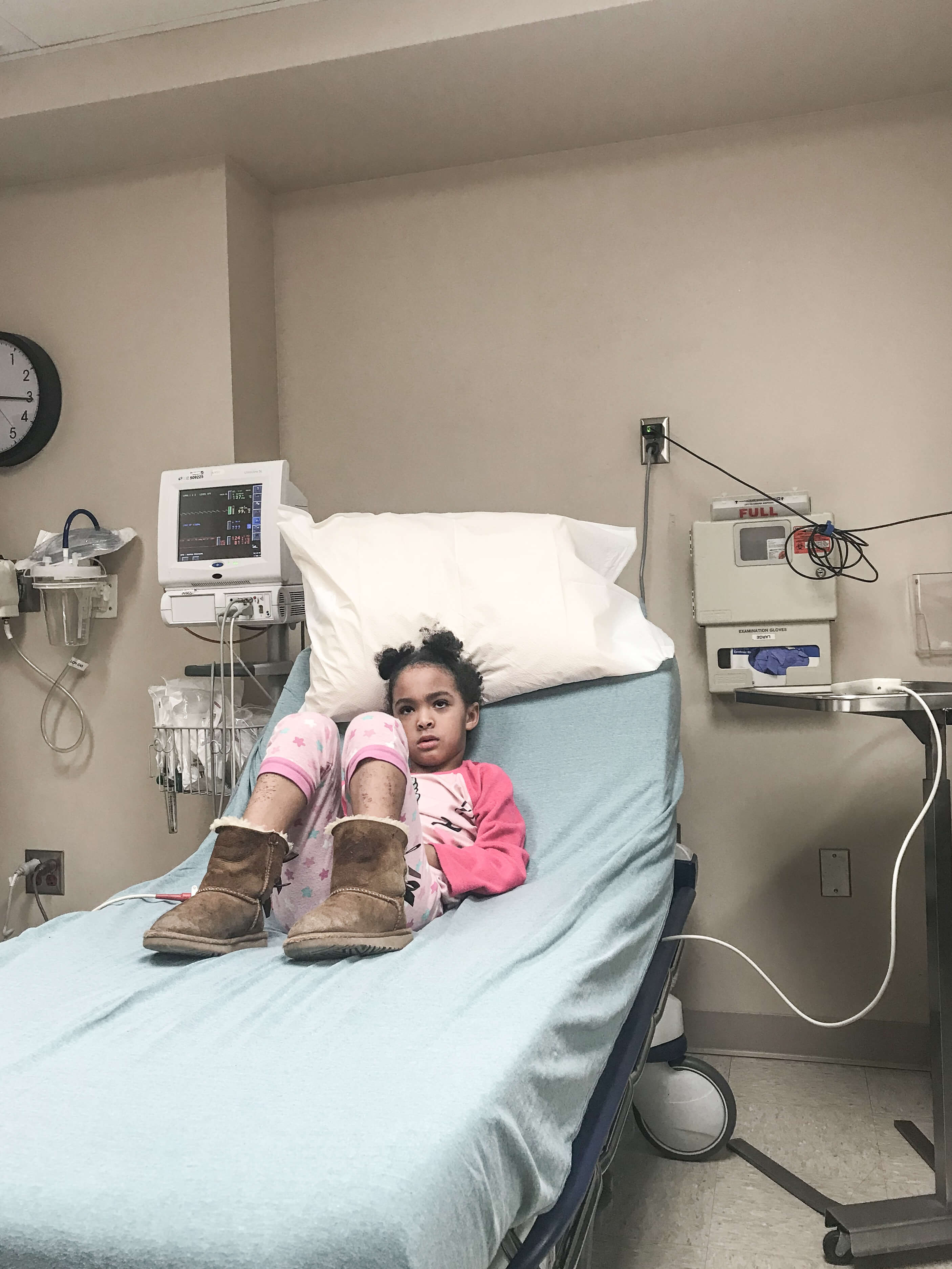 Severe Eczema in Children agutsygirl.com Samarah #eczema #acne #guthealth