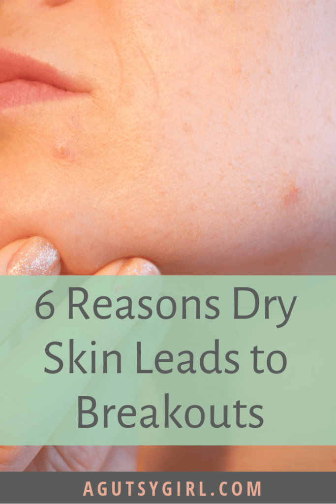 6 Reasons Dry Skin Leads to Breakouts agutsygirl.com #dryskin #skincare #skin #healthyliving #acne
