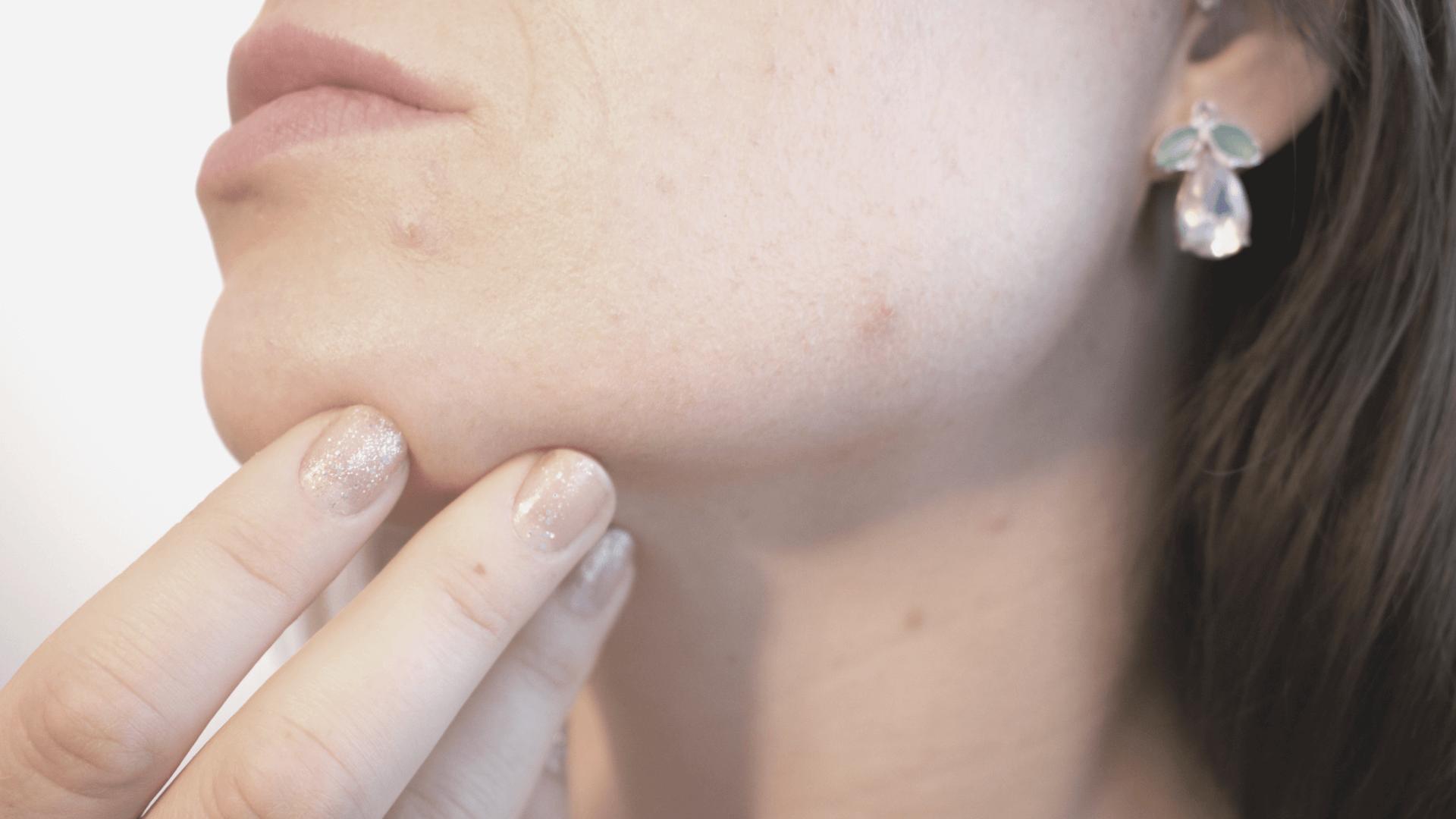 6 Reasons Dry Skin Leads to Breakouts