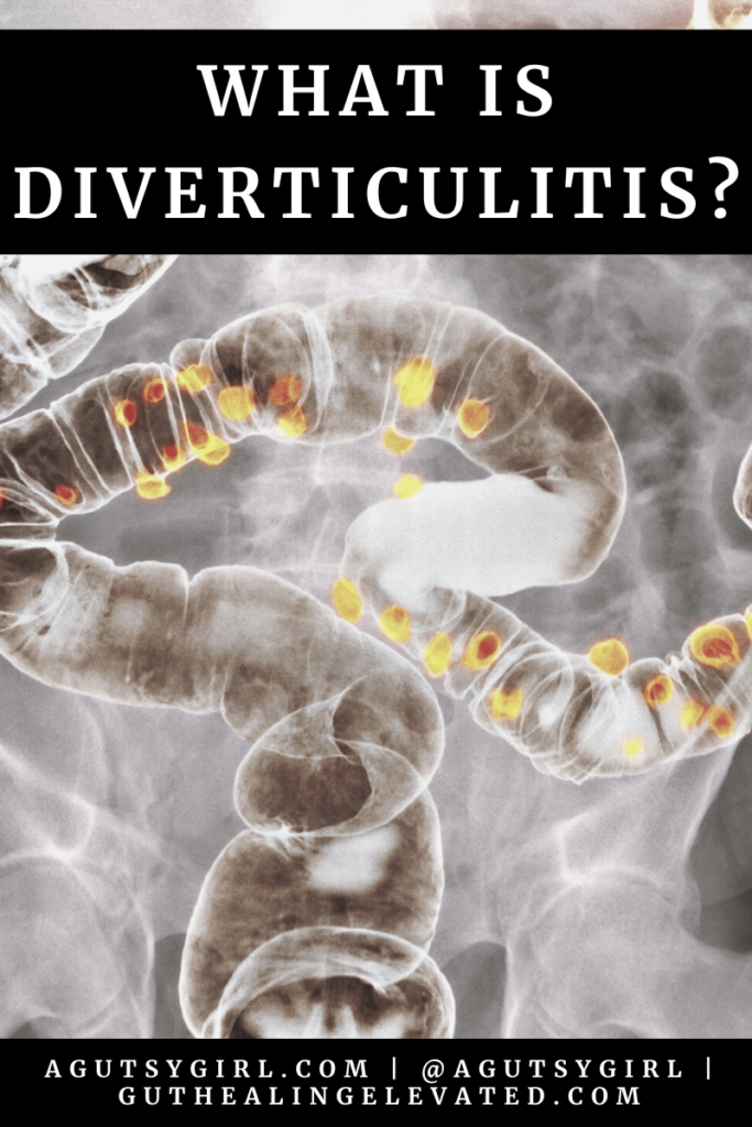 What is Diverticulitis agutsygirl.com
