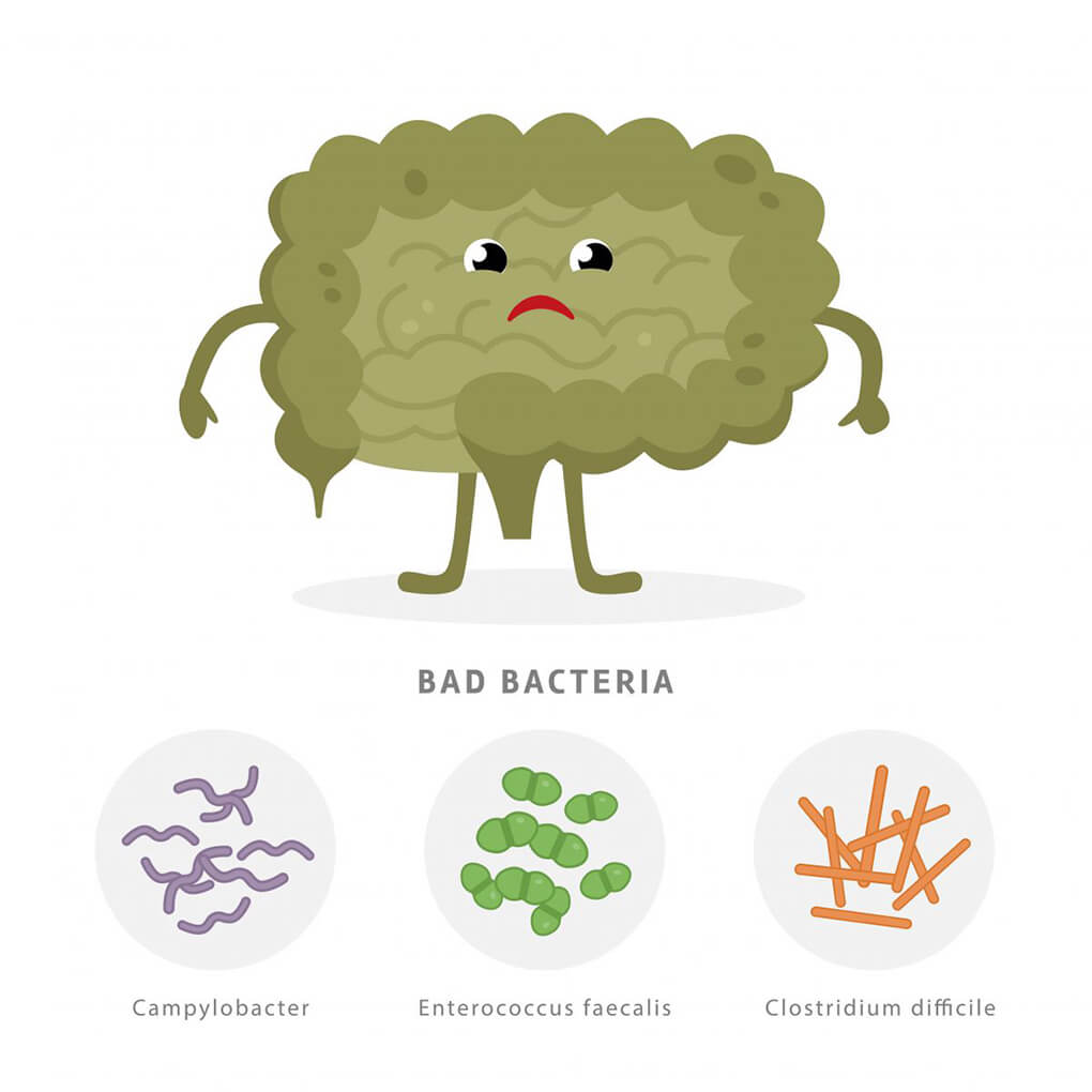 What is C Diff agutsygirl.com #cdiff #guthealth #gut Bezvershenko